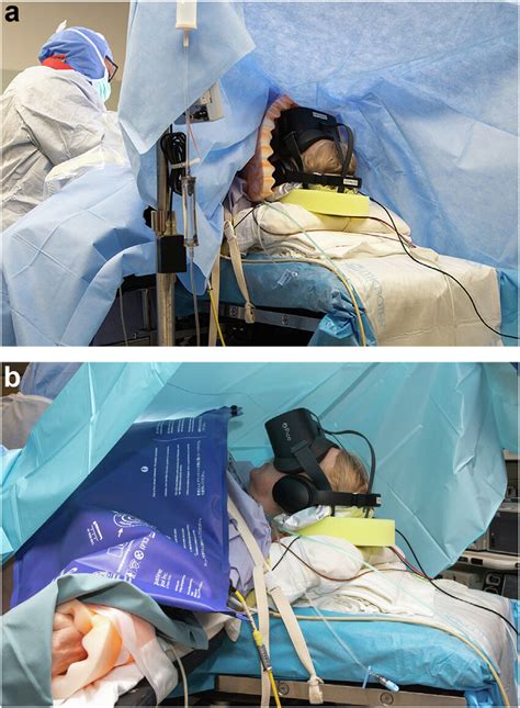 The <b>spinal</b> anesthetic for total <b>hip</b> arthroplasty that balances pain control with timely resolution of motor <b>block</b> has not been identified What This Article Tells Us That Is New In this randomized, three-arm study involving 154 patients, more individuals in the mepivacaine <b>spinal</b> group ambulated 3 to 3. . Spinal block and sedation for hip replacement